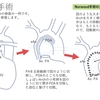 左心低形成症候群（HLHS）〜Norwood手術　疾患19