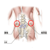 腰のリハビリ1回目。どうやら自分で考えるに、「変形性腰椎症」ではないだろうか。