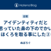 アイデンティティだと思っていた鼻の下のでかいほくろを取る事にした②