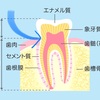 歯がしみる〜‼️その原因って😱❓