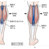 脚が攣る原因は食べ過ぎ。