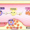 コレステロール対策「食事で減らそう　悪玉」