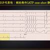 ECG-301：answer