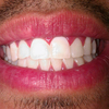 20 Myths About dents blanches dentiste: Busted