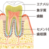 歯の治療をしています