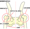 股関節形成不全