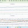 ★【　沖縄　貯水率　４３．７ ％　】★／【　宮崎　震度 ４　】／【　桜島　１０００ｍ　】／【　諏訪之瀬島　800m　】