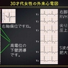 ECG-233：answer