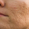 ﻿Pores and skin Conditions, Health Reference Center, CSULB