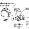 左下の犬歯と小臼歯の虫歯治療