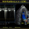 ECG-201：answer