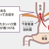 【閑話休題】もぞ、健康診断で要精密検査の判定下される　後編