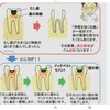 歯を削らない抜かないドッグベスト療法