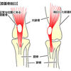 ひざの靭帯がきれる