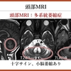 パーキンソン病を科学する３７