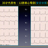 ECG-354：30才男性。動悸発作の既往がありあます。 = 心電図検定試験：傾向と対策 Q.002 =