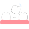 差し歯のフリーイラスト素材