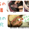 歯石除去キャンペーン🦷