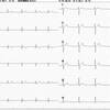 ECG-104：answer