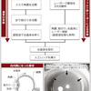 レーザーによる白内障手術