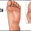 Hammer Toes Definition