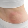 慢性皮膚疾患患者のニーズに焦点を当てた提言