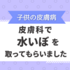 【子供の皮膚病】プールが始まる前に、皮膚科で水いぼを取ってもらいました