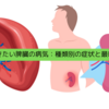 知っておきたい脾臓の病気：種類別の症状と最新治療情報