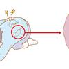 尿路結石の痛みは半端ない！！