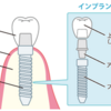 からだの体験記　その3