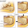 Common Sore Foot Culprits