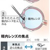 眼内レンズ、「単焦点」と「多焦点」