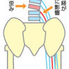 「ぎっくり腰」どうしたら避けられる？