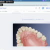 本格的にAIクラウン時代に〜Dentbird, SHINING3D, SprintRay比較〜