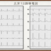 【コラム-140】：ECG Yellow web Book-006-肢誘導の付け違い問題- T-S method-その2】📕→📘→📙