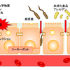 腸が漏れやすくなっていませんか？