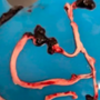 【 COVID-19 mRNA ワクチン 】血栓ショットのプランデミック展開：コビド注射によって引き起こされた【 繊維状のゴム状の血栓 】は、プリオンのような播種活性を持っています