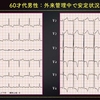 ECG-295：60才代の男性。外来通院患者さんです。