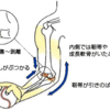 野球肘