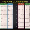 ECG-257：answer