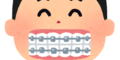 【歯列矯正】#18 ブラケット外し！リテーナー装着