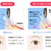 目の下のクマ・たるみの原因と施術の紹介