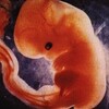 妊娠中絶５（参考１）