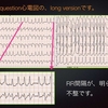 【ECG-185】answer