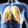 GCC Idiopathic Pulmonary Fibrosis Treatment Market 2022-2027: Trends, Size, Industry Share and Forecast