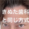 【インプラントの】きぬた歯科と同じ方式で！