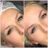 Why Microblading Is A Great Way To Enhance Eyebrows?