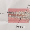 大人の歯列矯正 〜 装置が口内に当たって痛いときは？ 〜