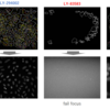 【CellProfiler】【KNIME】MeasureImageQualityでぼやけた画像を検出し，データセットから除去する