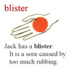 今日の単語: blister